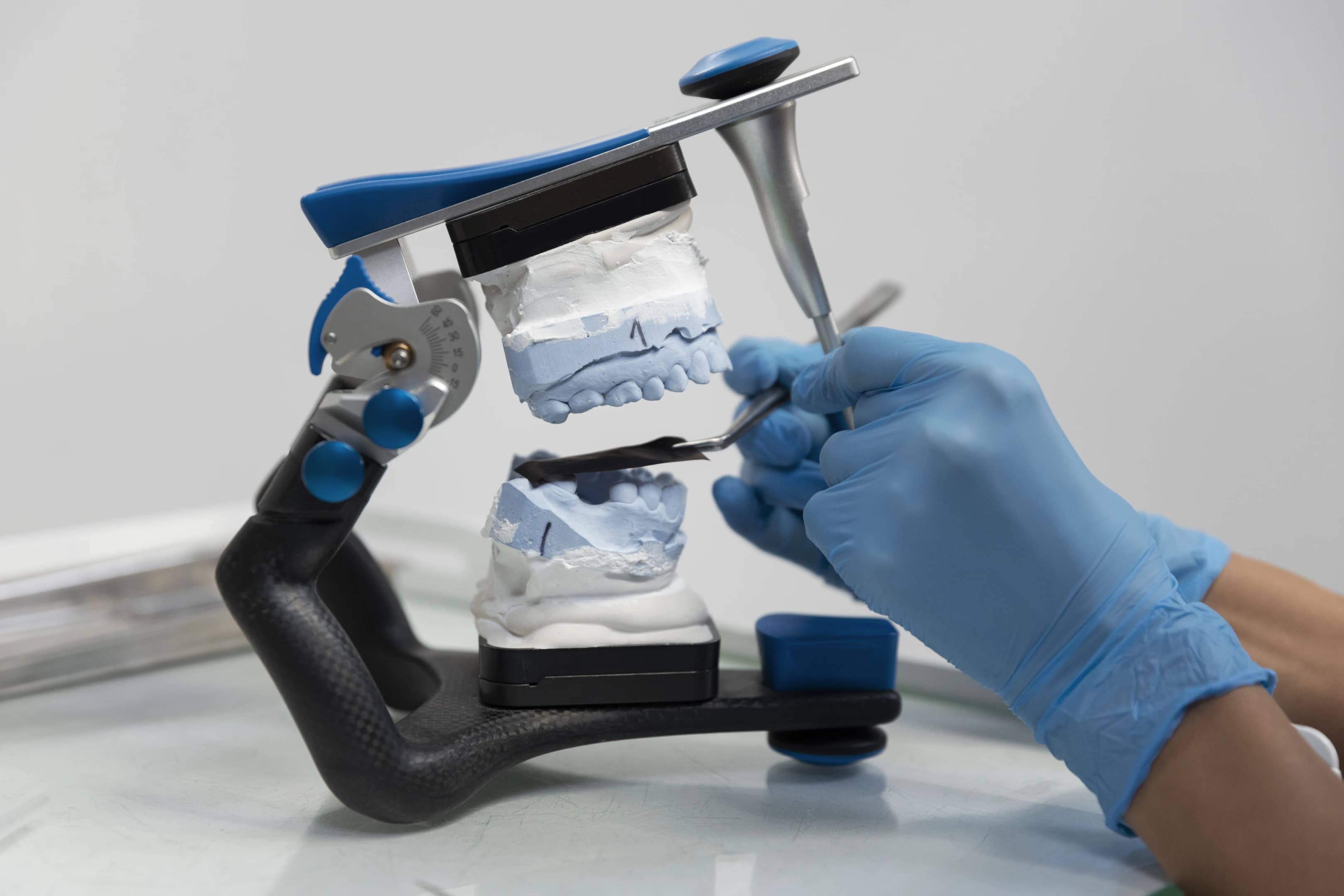 Сравнение съемных и несъемных протезов: что подойдет именно вам?